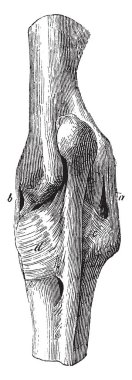 Dış yan bağ ve iç yan bağ mevcut olduğu, vintage çizgi çizme veya oyma illüstrasyon ligament dirsek eklem.