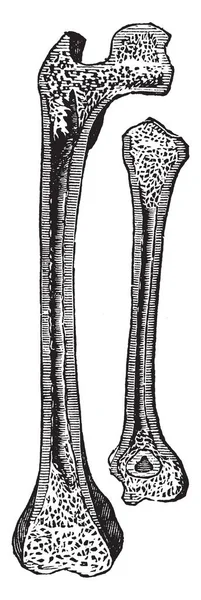 这个插图代表大腿骨和胳膊骨 复古线条画或雕刻插图 — 图库矢量图片