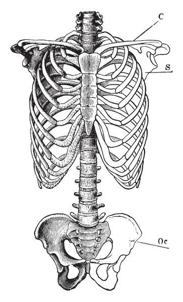 Questa Illustrazione Rappresenta Trunk Scheletrico Disegno Linee Vintage Illustrazione Incisione — Vettoriale Stock