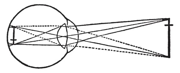 この図は 近視のビジョン ビンテージの線描画や彫刻イラスト — ストックベクタ