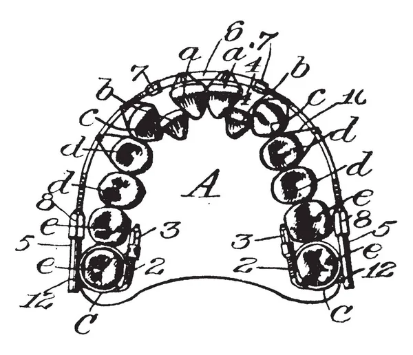 Ceci Est Mâchoire Dents Artificielles Dessin Ligne Vintage Illustration Gravure — Image vectorielle