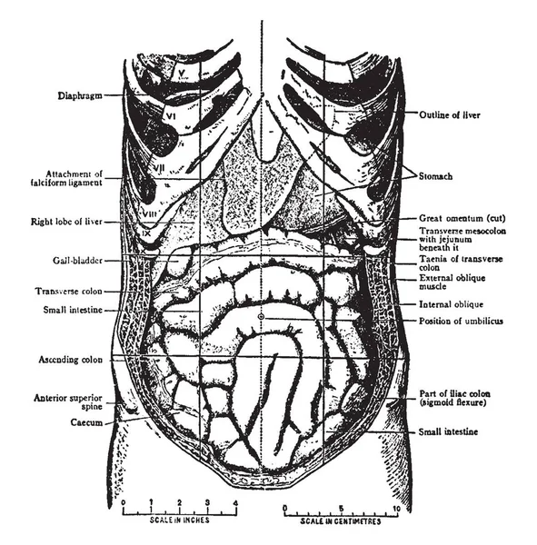 在原位的腹部内脏 当幅员被奠定开放和大网膜删除 复古线条画或雕刻插图 — 图库矢量图片