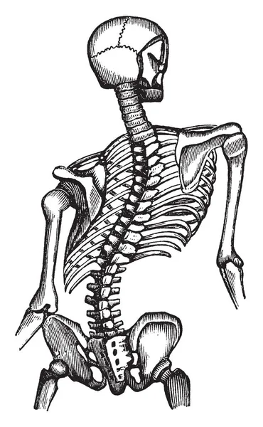 この図を表す変形胸郭 ビンテージの線描画や彫刻イラスト — ストックベクタ