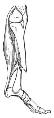 Bir kemik kırık olduğunda kan dışarı yaralı bölümleri arasında trickles ve sonra yavaş yavaş bir şurubu ya da jöle, vintage çizgi çizme veya oyma illüstrasyon gibi kalın olur bir yapışkan sulu sıvı için yer verir.