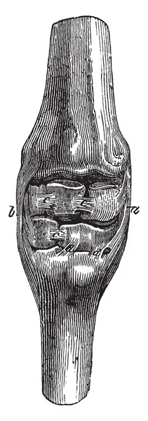 卡普斯的韧带 其中内部外侧韧带和外部外侧韧带出现 复古线画或雕刻插图 — 图库矢量图片