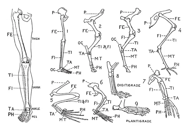 Этой Иллюстрации Показаны Человеческая Нога Сравнительные Диаграммы Показывающие Изменения Ноге — стоковый вектор