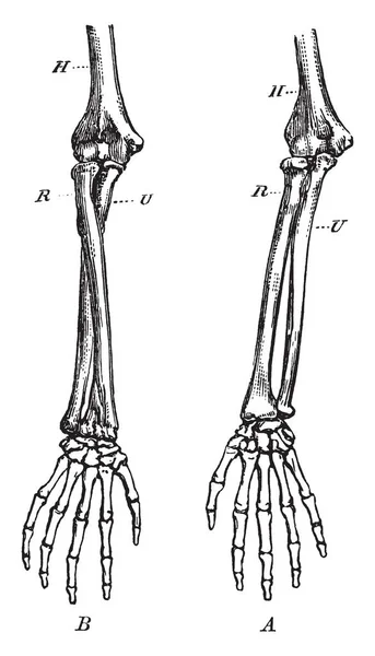Dieses Diagramm Zeigt Die Knochen Des Rechten Vorderarmes Vintage Linienzeichnung — Stockvektor