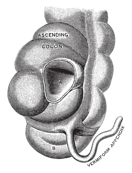 Este Diagrama Representa Apéndice Vermiforme Dibujo Líneas Vintage Ilustración Grabado — Archivo Imágenes Vectoriales