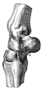 Dış yan bağ, vintage çizgi çizme veya oyma illüstrasyon Carpus derin bölümlerini derin bağlar.