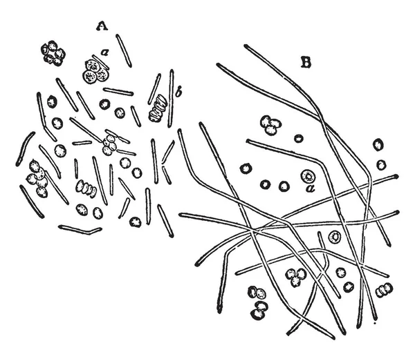 Bacilli Mescolati Con Corpuscoli Sangue Provenienti Dal Sangue Porcellino India — Vettoriale Stock