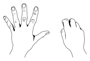 Bir elin yakın plan resmi, biri açık avuç içi ve diğeri yakın avuçla, klasik çizgi çizimi veya kabartma çizimi ile.