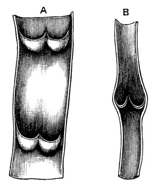 Damarın işlevi, arterler kanı dışarı çıkardıktan sonra oksijensiz kanı kalbe geri götürmektir. Burada gösterilen, damarın bir parçası açık vaziyette, bir damarın iki çift kapakçığı ve boylamsal kesimi ile, vintage çizgi çizimi veya oyma çizimi