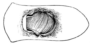 Deniz Salyangozu, Lymnaeidae familyasından sarmal kabuklu, tuzlu suda yaşayan, klasik çizim ya da kabartma resimli bir deniz yumuşakçasıdır..