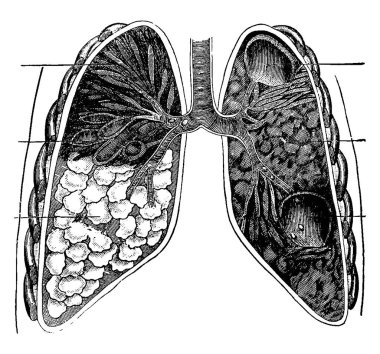 Ciğerlerin iç yapısı işlevi, solunum, vintage çizgi çizimi veya kabartma çizimi adı verilen gaz değişim sürecidir..