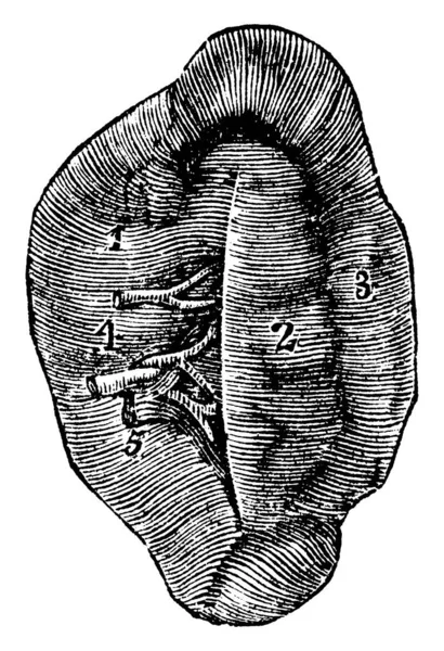 Dalak, göğüs kafesinin altındaki lenf sisteminde bulunan ve bağışıklık sisteminin bir parçası olarak kan filtresi görevi gören bir organdır..