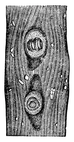 Trichina Spiralis Name Given Peculiar Nematoid Worm Which Inhabits Muscles — Vector de stock