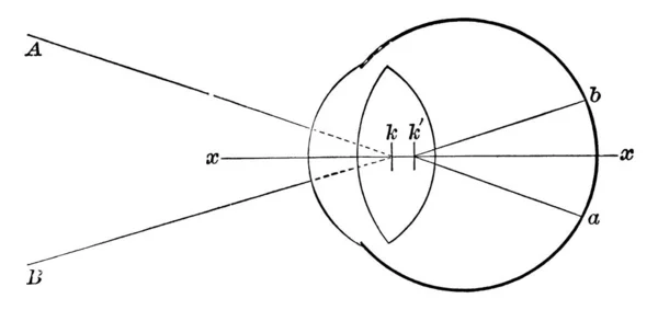 显示入射射线与视网膜 第一个交点 第二个交点 的相交点 的图像形成点的相交点 其他排列和工作点 古代线绘图或刻蚀菌 — 图库矢量图片