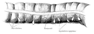 İki yaşındaki bir çocuğa ait bir enine kolon parçası, evlat. İnce bağırsağın üç ana özelliği olan 