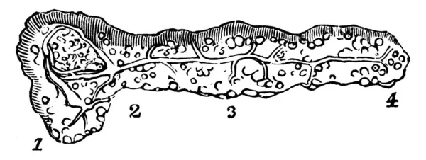 Pancreas Organo Che Scarica Succhi Digestivi Nell Intestino Tenue Insulina — Vettoriale Stock