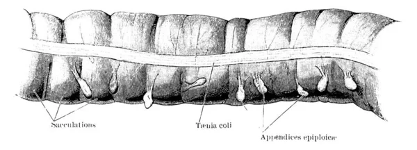 Piece Transverse Colon Two Years Old Kid Depicts Sacculatiousm Taeniaem — Stock Vector