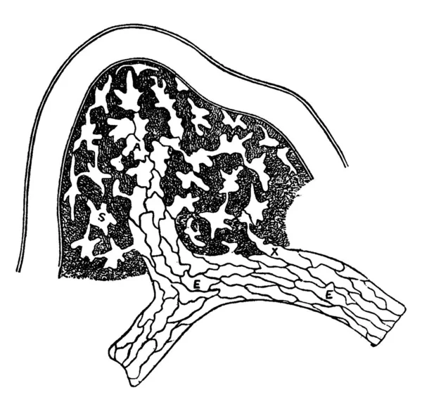 显示淋巴学的起源 其作用和部位标记为淋巴空间与淋巴病灶的联系 淋巴空间与淋巴管内皮细胞结合形成淋巴壁的来源 古老的线条画或铭刻 — 图库矢量图片