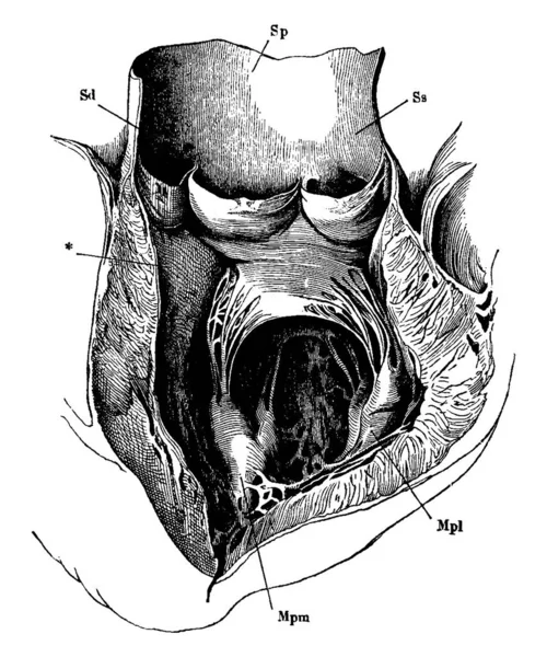 Een Typische Weergave Van Linker Ventrikel Het Begin Van Aorta — Stockvector