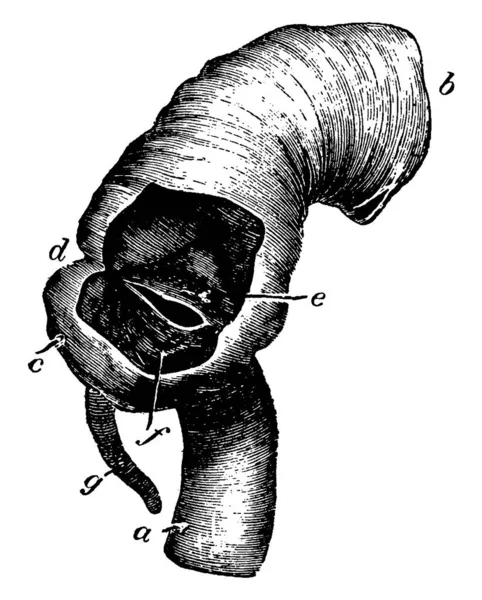 Илеоцекальный Клапан Тонкий Кишечник Соединяется Толстым Маркировкой Частей Рисунок Винтажной — стоковый вектор
