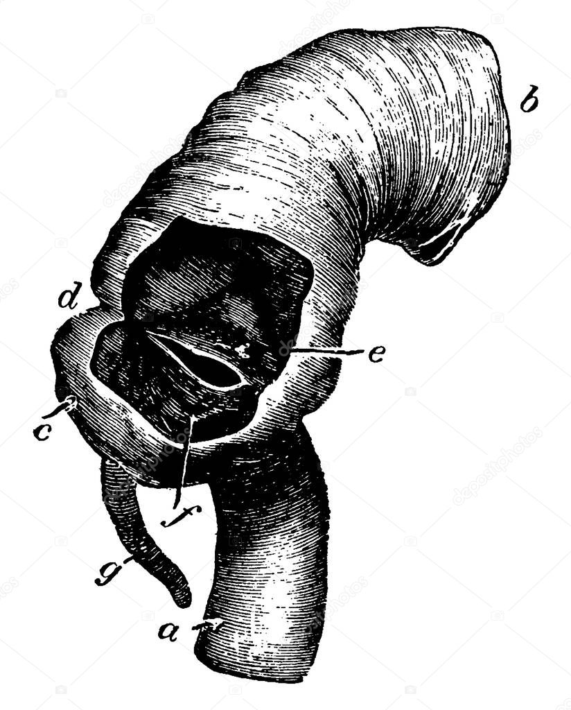 Morphart