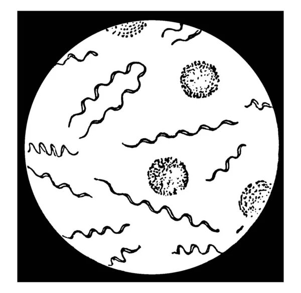 Una Imagen Spirochaeta Obermeieri Magnificado Causa Enfermedad Que Tiene Diferentes — Vector de stock