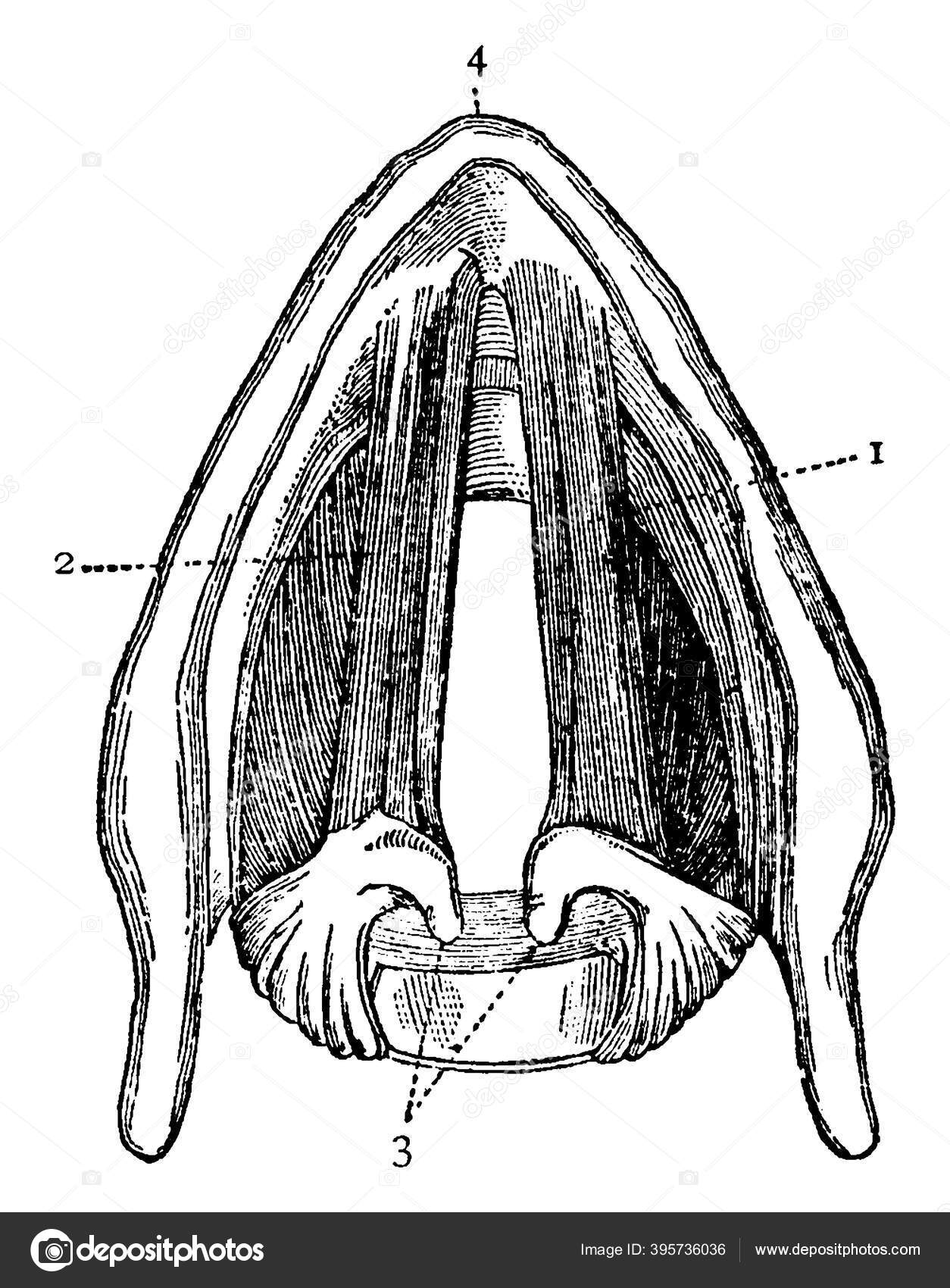 File:Interior of a larynx after tracheotomy Wellcome L0062705.jpg -  Wikimedia Commons