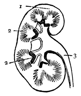 Böbreklerin bir bölümünün tipik bir temsili, 1: böbreğin gövdesi; 2: iç damarlar ve 3: üreter, mesaneye, klasik çizime ya da kabartma çizimine götüren.
