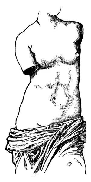 Efecto Del Uso Del Corsé Respiración Torso Estatua Conocida Como — Vector de stock