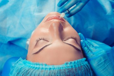 Dudak enjeksiyon. Düzeltme formu alt dudak. Enjeksiyon güzellik. Spa. Yüz gençleştirme. Dudak büyütme. Baş tarafında yukarıda görüntülemek