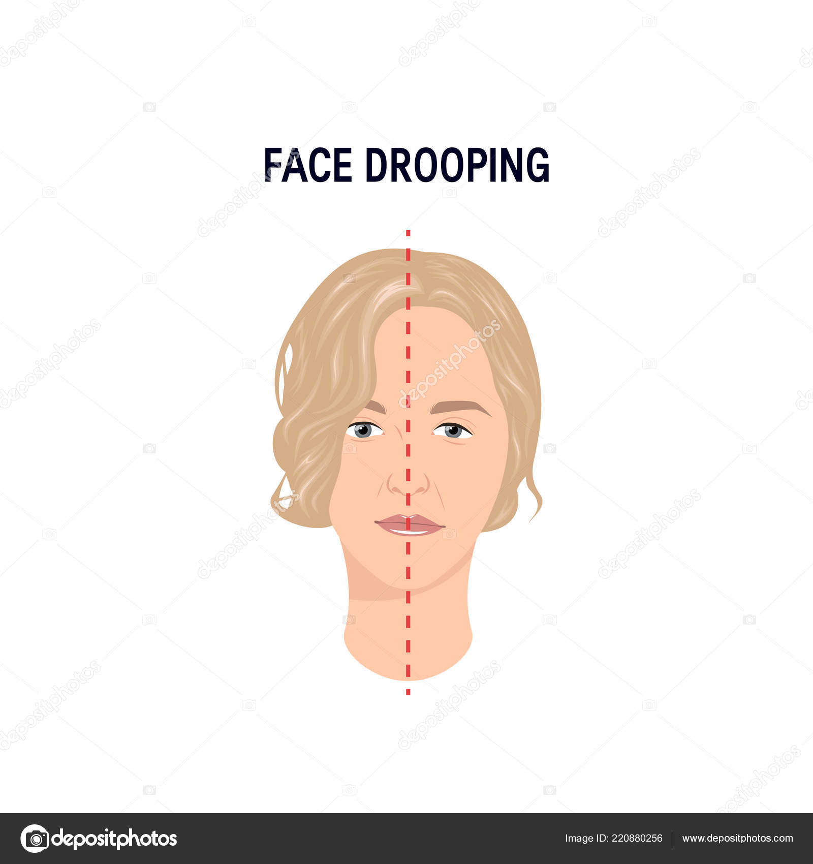 Face drooping concept — Stock Vector © marina_ua 220880256