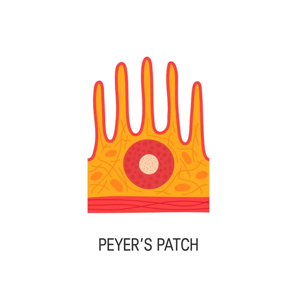 Ilustração vetorial do patch de Peyer — Vetor de Stock