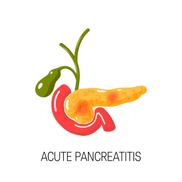 Concepto de pancreatitis aguda. Ilustración vectorial — Archivo Imágenes Vectoriales