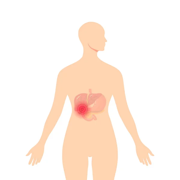 Ilustración médica del conducto biliar, vector — Vector de stock