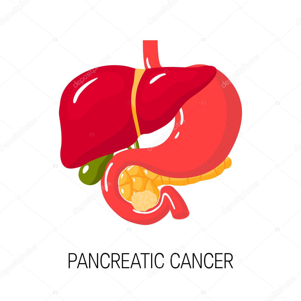 Pancreatic cancer concept. Vector illustration