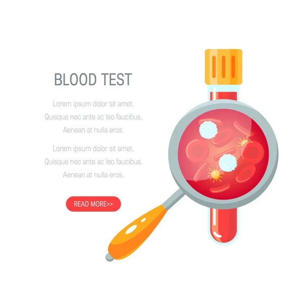 血液测试概念, 扁平化的矢量设计 — 图库矢量图片