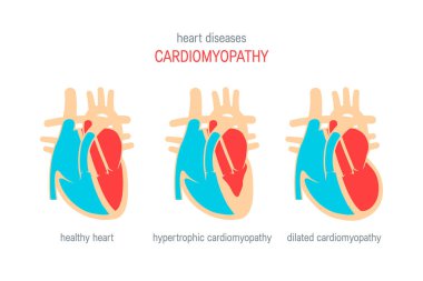 Heart disease vector concept in flat style clipart
