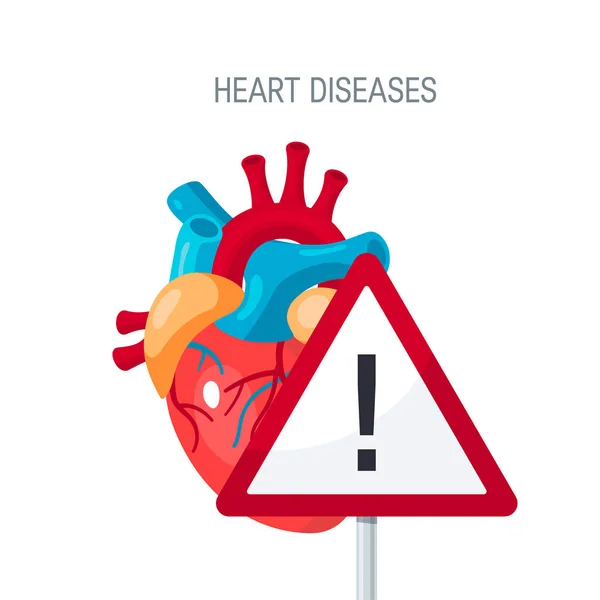 Heart diseases vector concept in flat style — Stock Vector