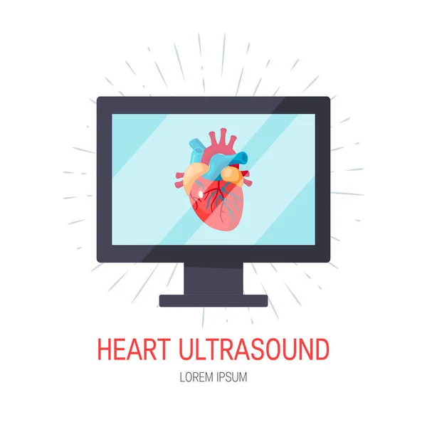 Heart ultrasound concept in flat style, vector — Stock Vector