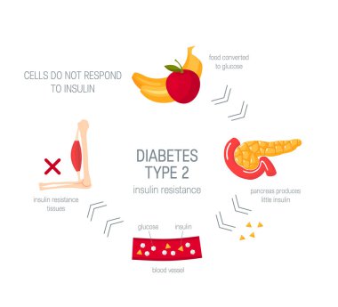 Diabetes type 2 concept in flat style, vector clipart