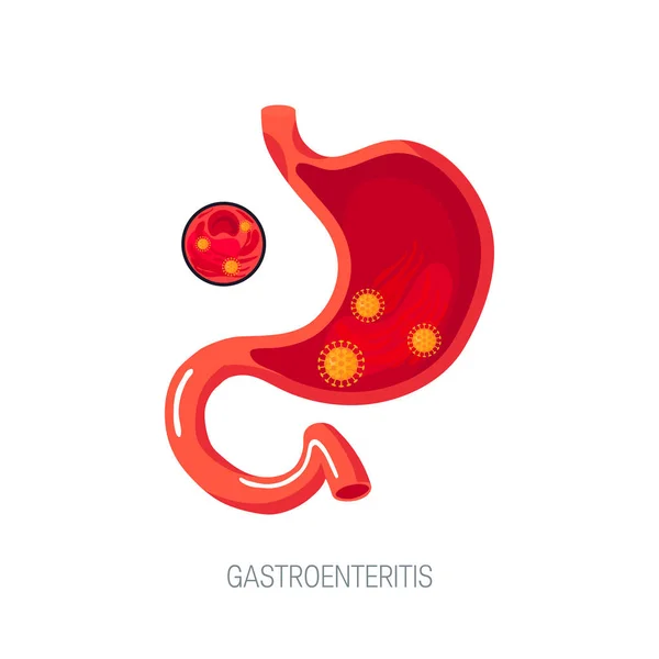 Gastroenteritida koncept v ploché styl, vektorové ikony — Stockový vektor