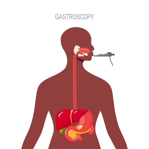 Endoskopie diagnostické, vektorové koncept v plochý — Stockový vektor