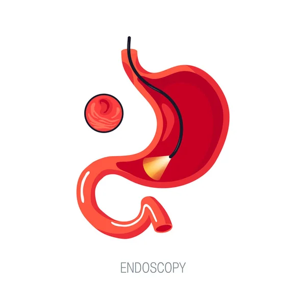 Diagnóstico endoscópico, concepto vectorial en estilo plano — Vector de stock