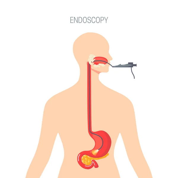 Diagnostica endoscopica, concetto vettoriale in stile piatto — Vettoriale Stock