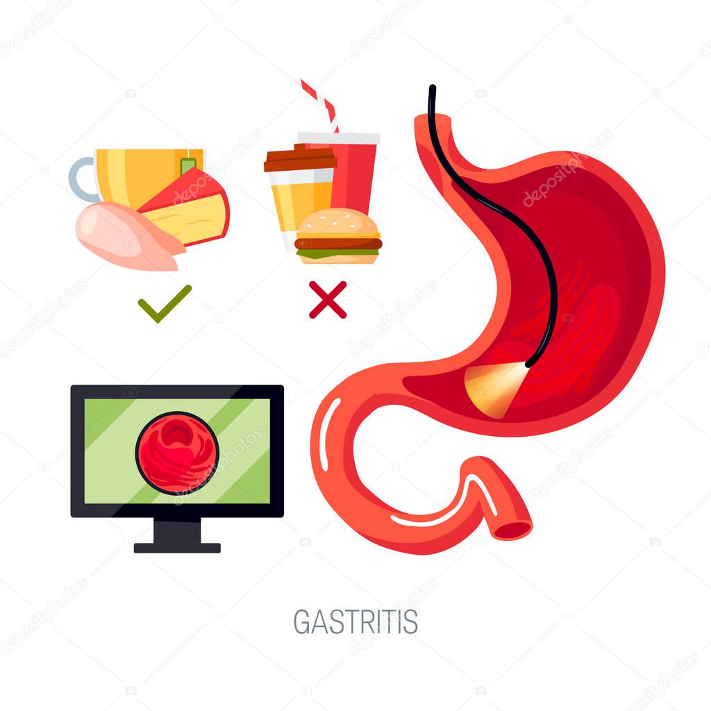 Gastritis concept in flat style, vector icon