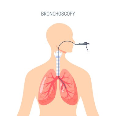 Lungs diagnostic vector design in flat style clipart