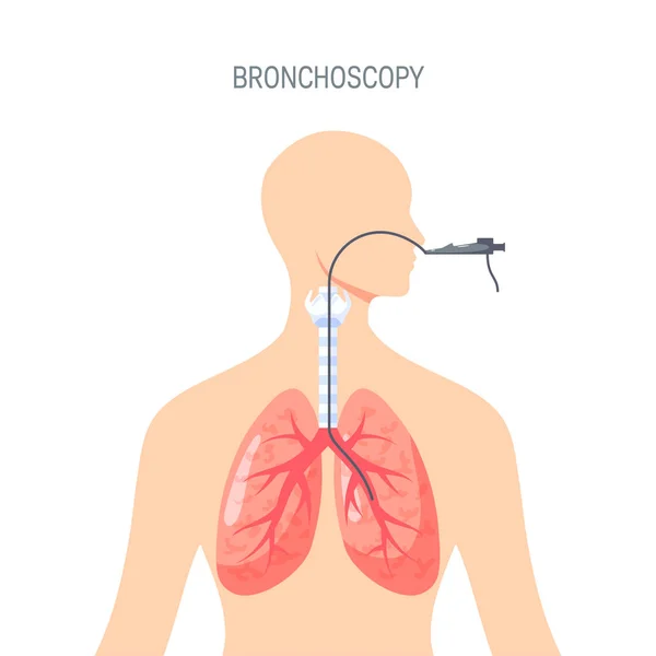 Longen diagnostische vector design in vlakke stijl — Stockvector